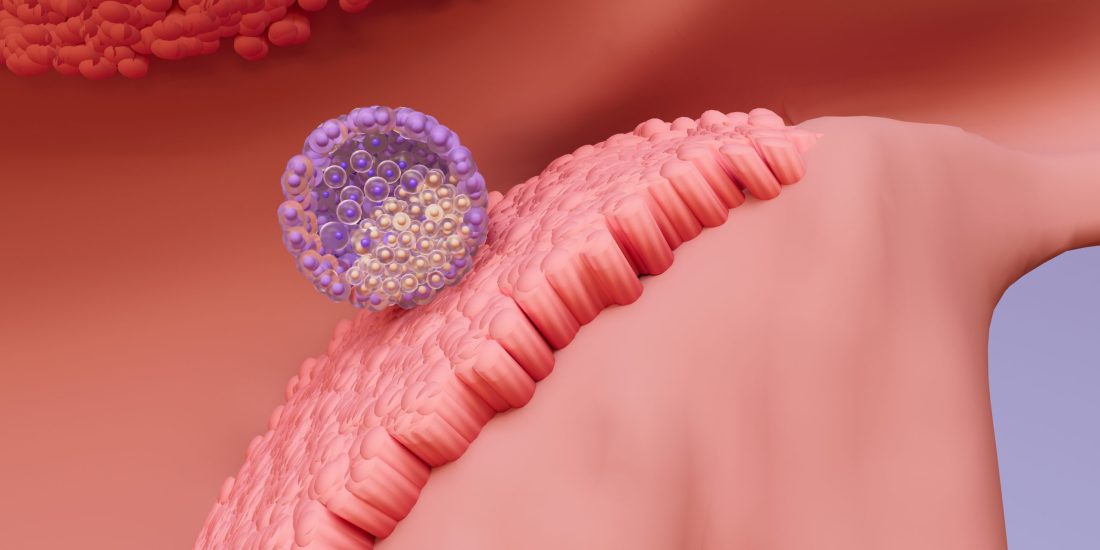 Embryo Transfer: The Most Anticipated Step in the IVF Journey